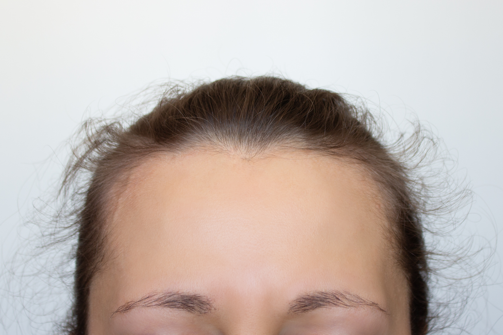 Masterklinikken Hoey Haarlinje