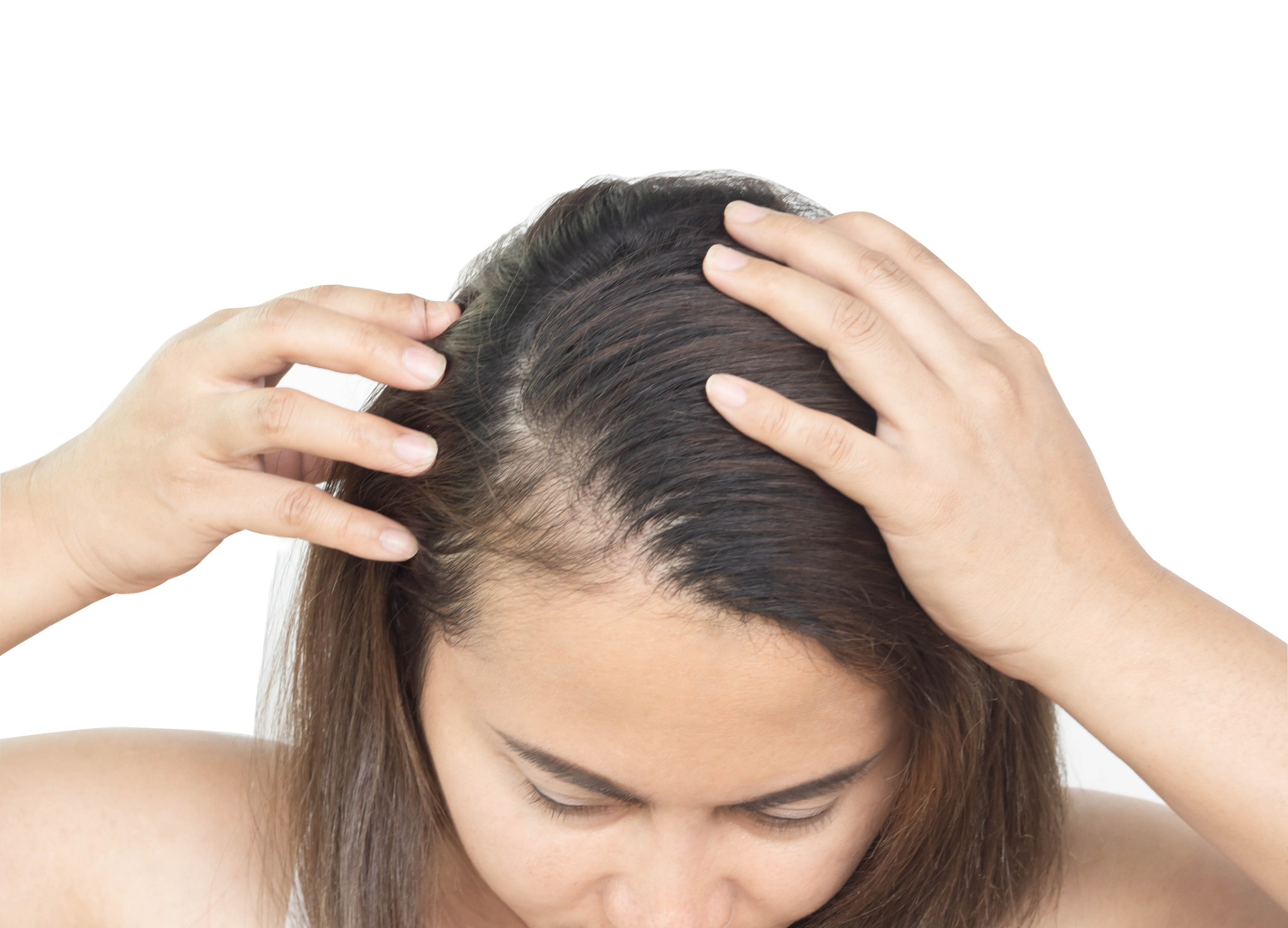 Kvinne Hartap Fodsel Hairloss After Birth